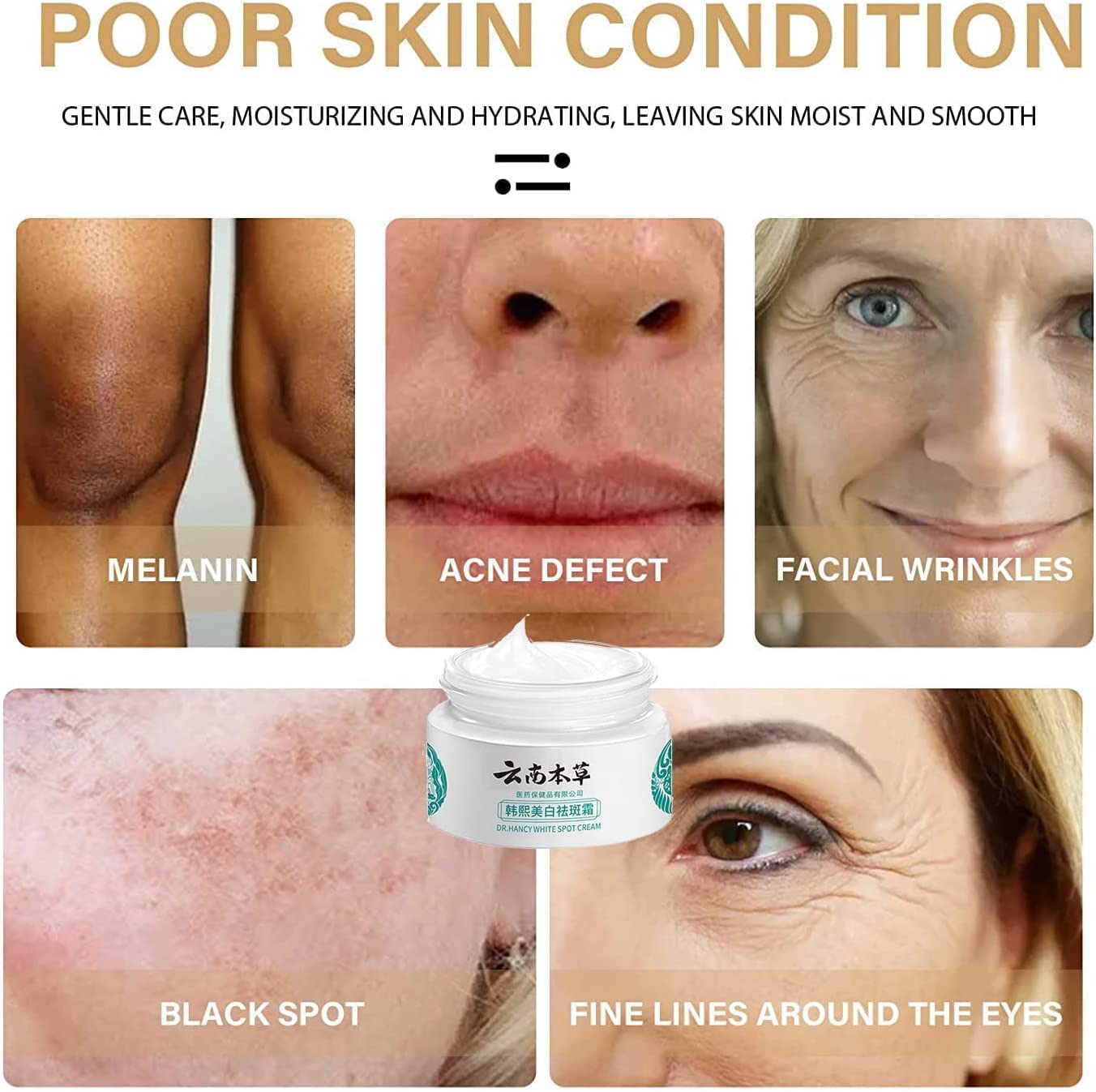 🌿Yunnan Herbal Whitening and Freckle-Removing Cream: Fades Spots and Brightens Skin Tone 🌟