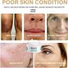 🌿Yunnan Herbal Whitening and Freckle-Removing Cream: Fades Spots and Brightens Skin Tone 🌟