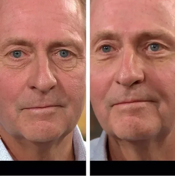🔥Last Day Promotion 49% OFF🔥-Temporary Firming Eye Cream（Video of the same eye cream）