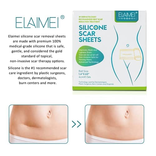 🔥Last Day Promotion 70% OFF-🔥-ELAIMEI  self-adhesive silicone scar patch