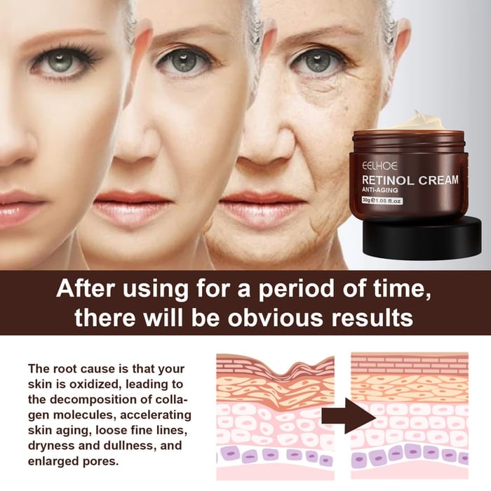 Last Day Promotion 75% OFF -🔥 Retinol Anti Aging Wrinkle Removal Skin Firming Cream🔥