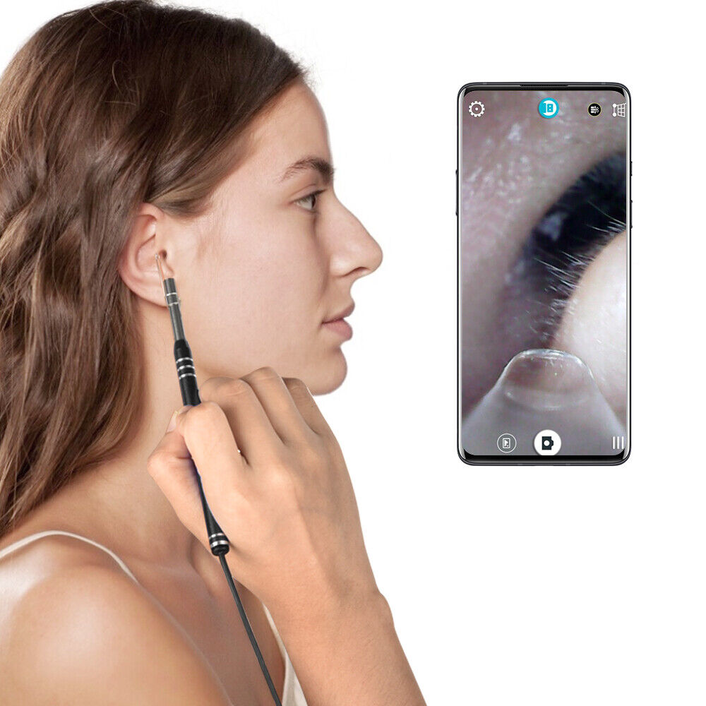 (🌲Early Christmas Sale- SAVE 48% OFF)3 In 1 Ear Cleaner Digital Otoscope(BUY 2 GET 1 FREE NOW)
