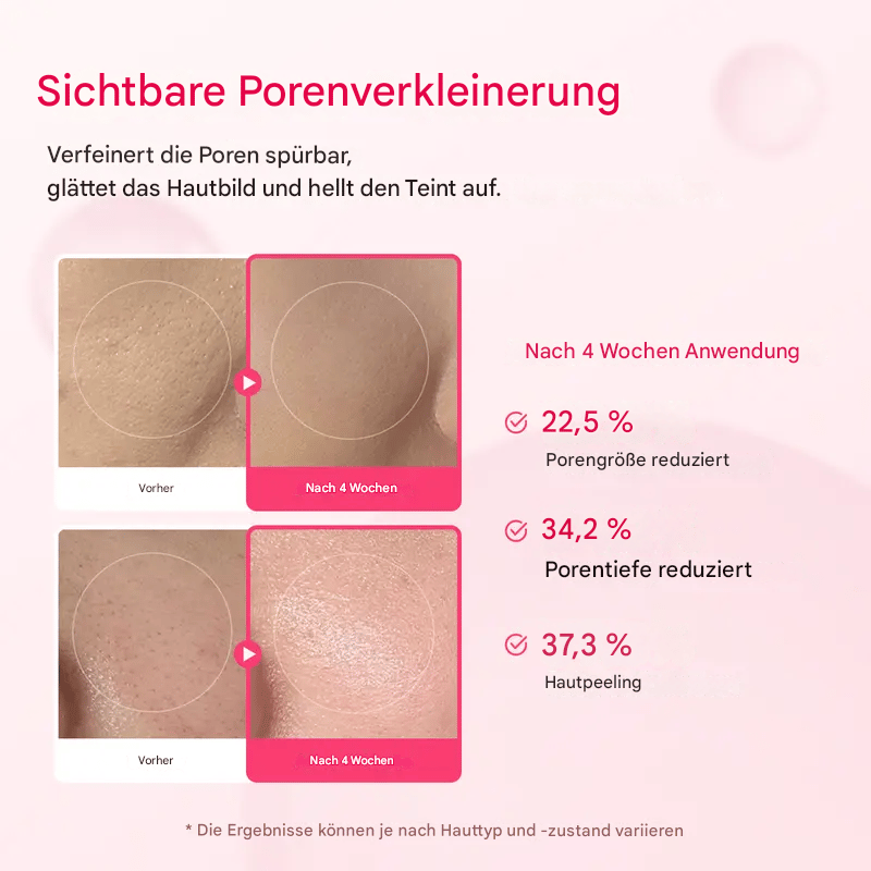 🔥Sonderangebote dieser Woche🔥Lumi Pore & Spot Care Duo