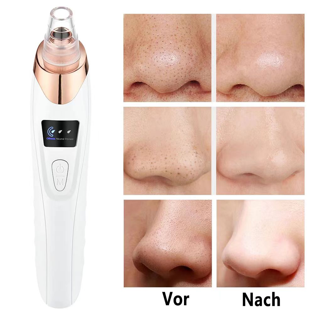 🔥Instrument zur Reinigung der Gesichtsporen