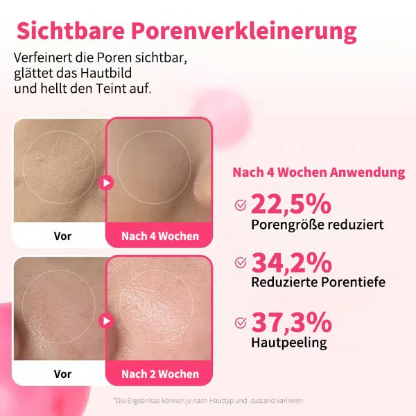 🔥Letzter Tag 49% Rabatt✨Klare‑Haut Pflege‑Duo