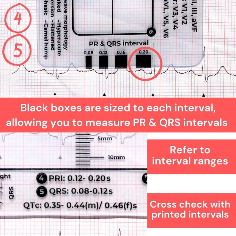 🔥Black Friday Sale 48% OFF🎁ECG 7 Step Ruler🩺