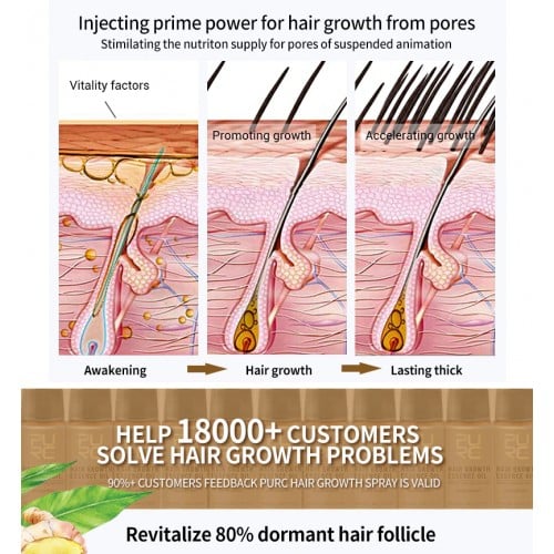 💥2023 New Hair Growth Spray - Fast Hair Growth - Prevent Hair Loss【🔥Buy 1 Get 1 Free🔥】