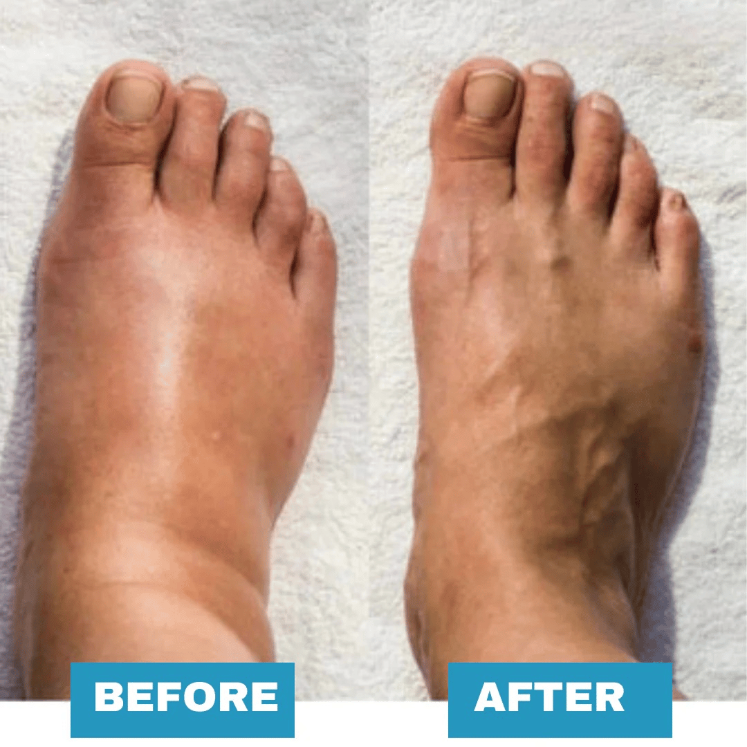🔥Last Day 49% OFF - Foot Massager - For Lasting Foot Pain Relief