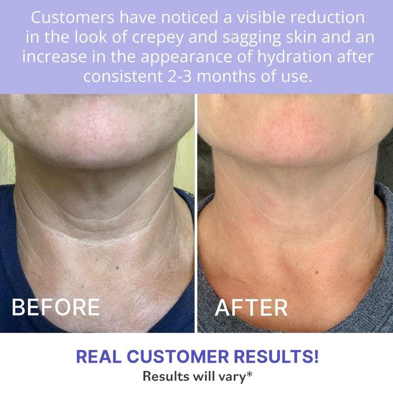 🔥Last Day Promotion 50% OFF🔥Tighten & Lift Firming Neck Cream