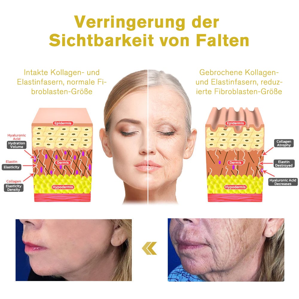 Dr. Smiths empfohlene OTEH™ Hautstraffungscreme – 60 % Rabatt für kurze Zeit! 🛍️