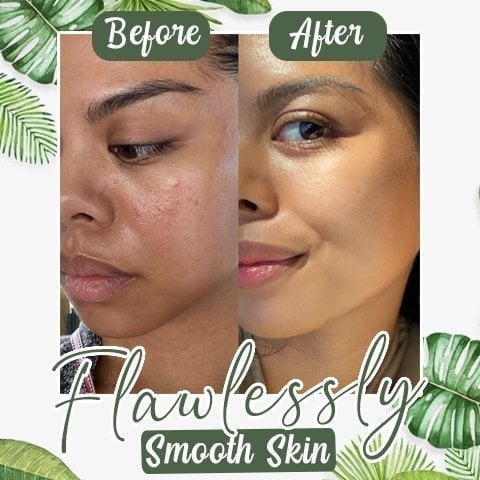 ✨Free shipping-Last Day 75% OFF 🔥-🍵 Deep Cleanse Green Tea Mask