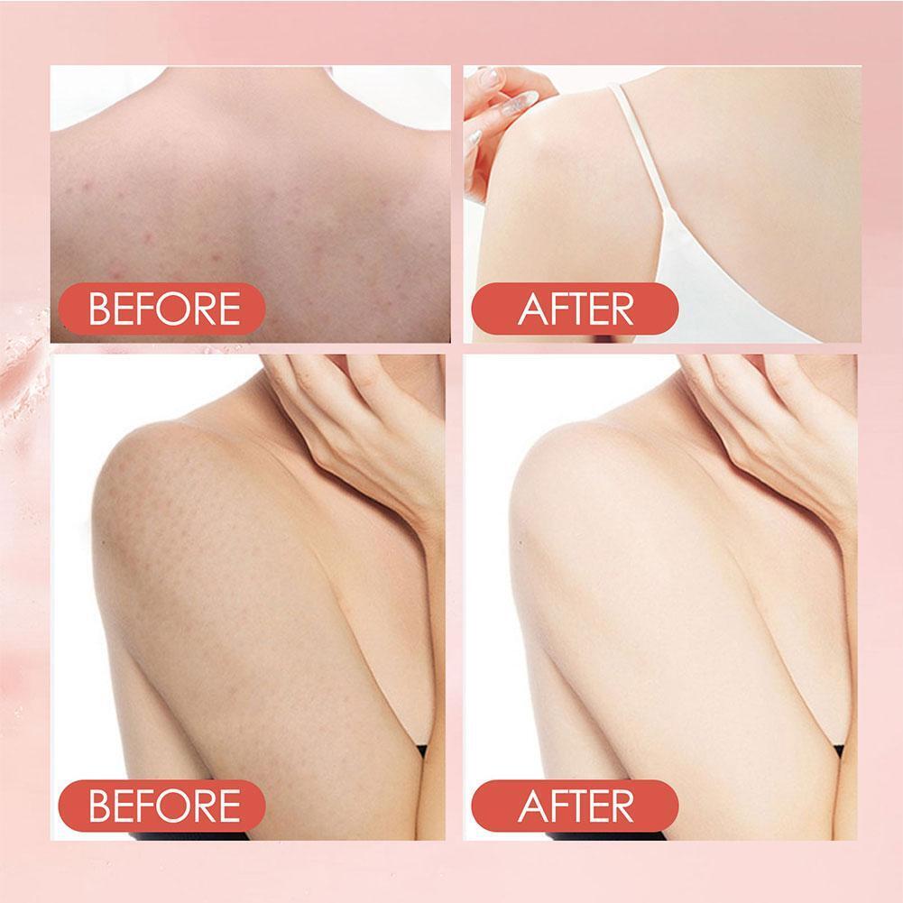 🔥Limited Time Sale 48% OFF🎉Exfoliating Clean Mud Rubbing Gel-Buy 1 Free 1