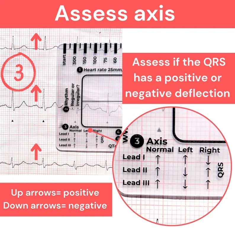 ECG 7 Step Ruler