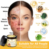 BENDCHARGE™ Bee Essence Skin Treatment Cream (AAD Recommended👨‍⚕️)