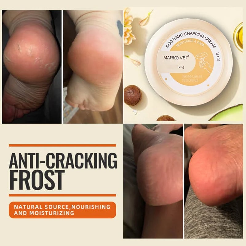 🎁Mother's Day Sale 50% OFF- 🎁Anti-Cracking Frost