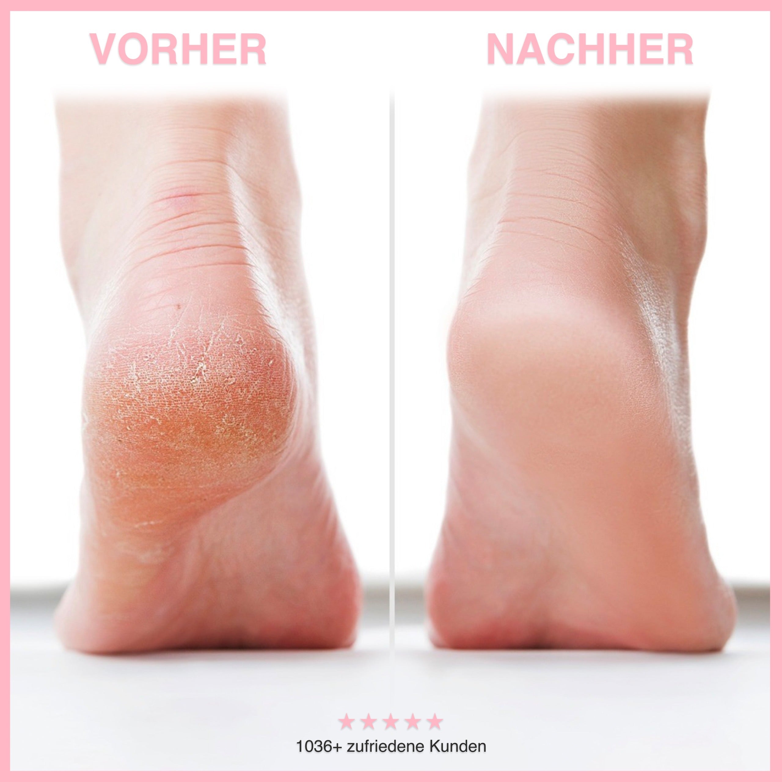 🔥Letzter Tag 50% RABATT-Tschüss rissige Haut – Hallo samtweiche Füße!
