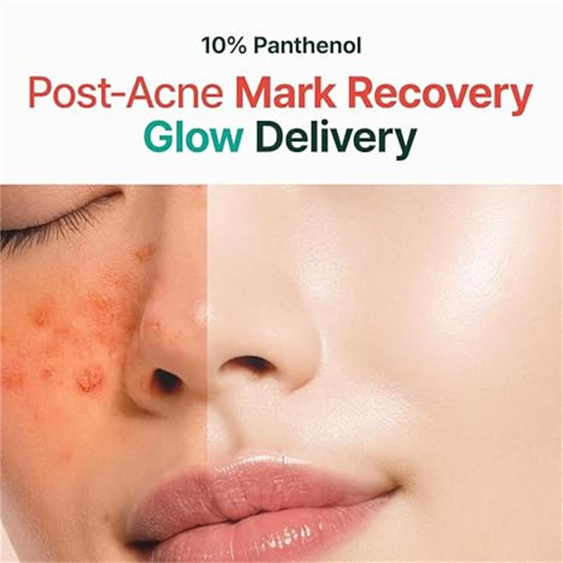 🎁TikTok Last Day Sale - 70% OFF🎉 PURITO B5 Panthenol Brightening Cream - Repair Acne Damage & Reveal Luminous Skin! 🌟