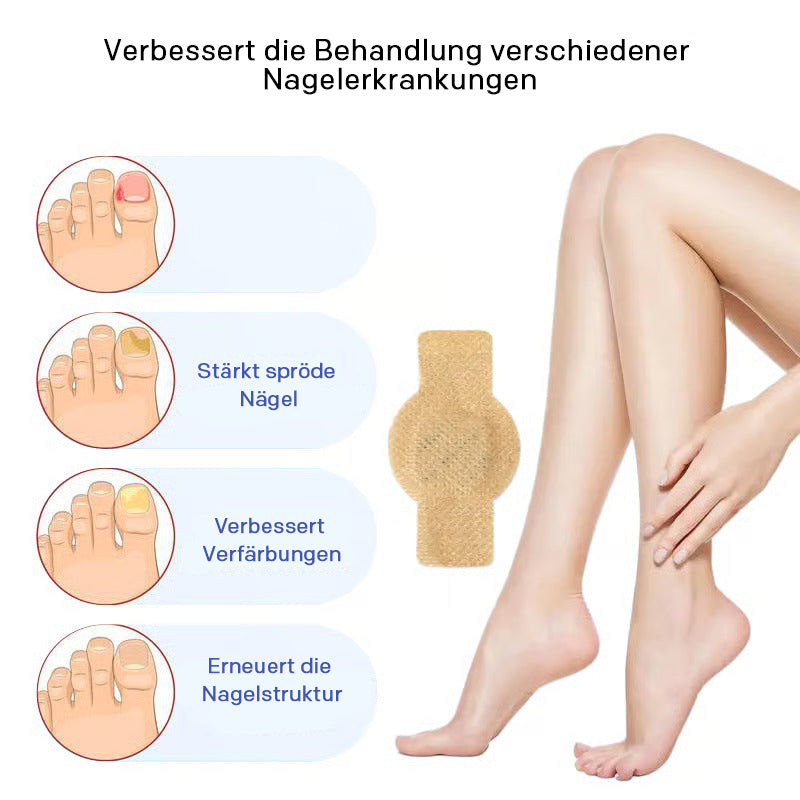 🔥Letzter Tag Verkauf 49% Rabatt🔥Onychomykose-Aufkleber