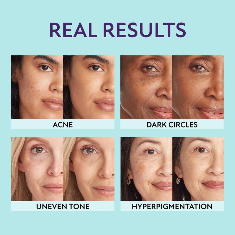 Beauty Supreme Crème – All-in-one moisturizer, concealer & coverage✨💧Lightweight & waterproof
