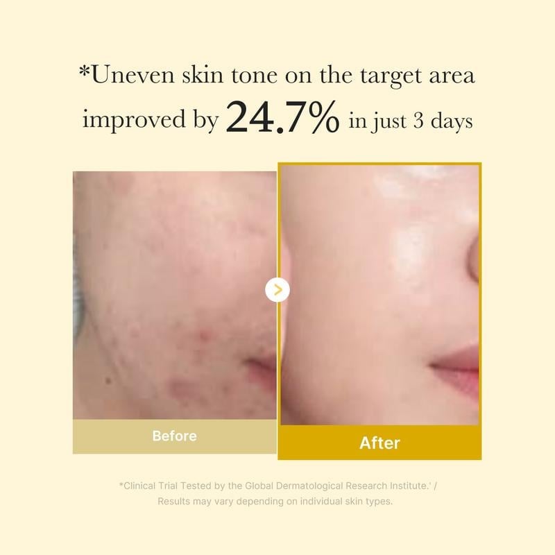 🎁TikTok Spring Last Day Promotion 70% OFF-🎁-✨ Kojic Acid Turmeric Night Wrapping Mask