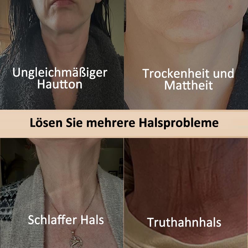 🔥Letzter Tag 50% RABATT-  Straffende Halscreme🍃