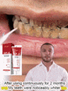 Intensive Teeth Whitening Toothpaste