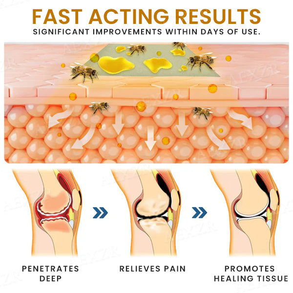 💥LAST DAY SALE 50% OFF💥Bee Venom Bones & Joint Repair Cream