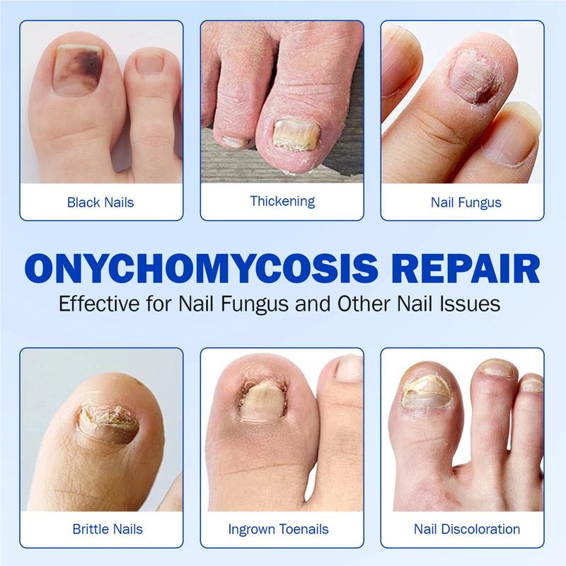🔥LAST DAY ONLY 50% OFF🔥21 Pcs Fungal Nail Patches⚡BUY 3 GET 1 FREE
