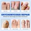 🔥LAST DAY ONLY 50% OFF🔥21 Pcs Fungal Nail Patches⚡BUY 3 GET 1 FREE