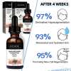 Last Day Promotion 49% OFF - 🔥2023 New Botox Face Serum