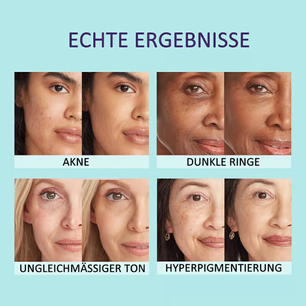 🔥LETZTER TAG 49 % RABATT🌟Körper-Concealer-Perfektionscreme – Feuchtigkeitsspendend, langanhaltend, leicht und wasserfest, 4 in 1💧✨
