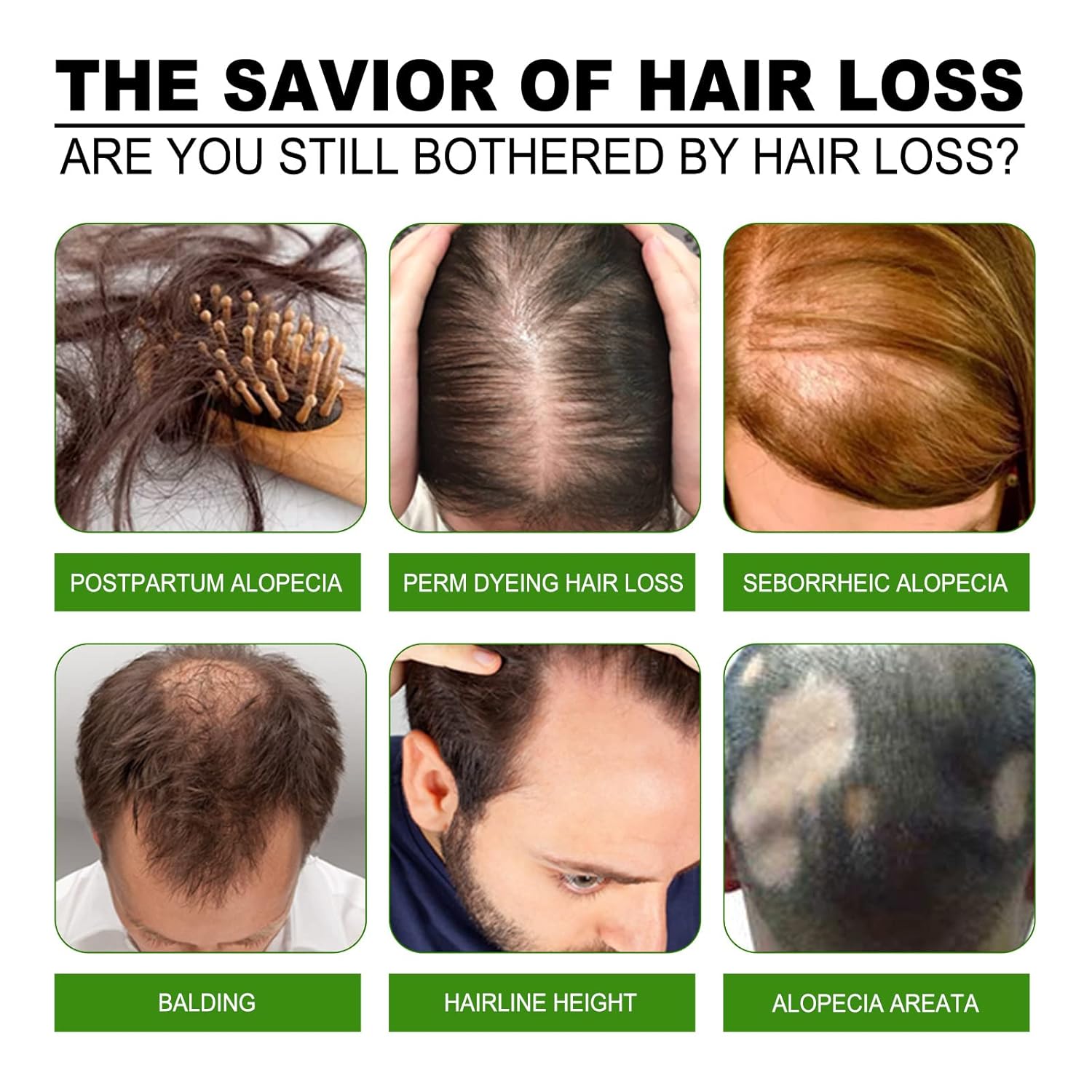 Microneedle Hair Regrowth System Hair Thickening Solution