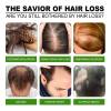 Microneedle Hair Regrowth System Hair Thickening Solution