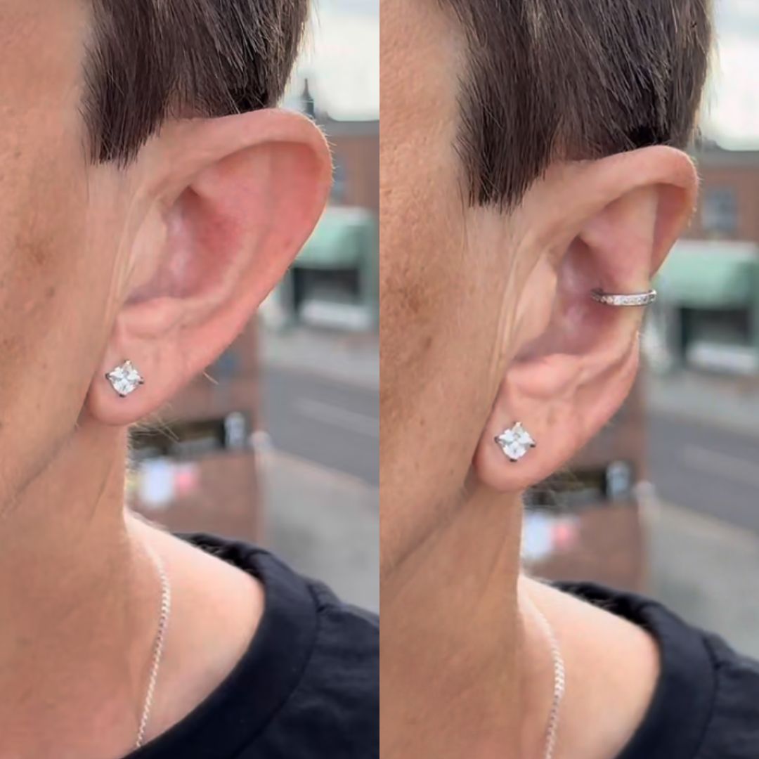 🔥Last Day Promotion 70% OFF🔥925 Silver - Aesthetic Ear Correction without Surgery