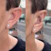 🔥Last Day Promotion 70% OFF🔥925 Silver - Aesthetic Ear Correction without Surgery