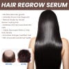🔥Last Day Promotion 50% OFF🔥Hair Growth Serum