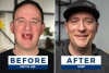 Clinclii™ Moldable False Teeth Restore Your Smile, Anytime. Anywhere