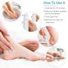 🔥Last Day Promotion 50% OFF💥Electric Feet Callus Remover