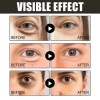🔥【Best discounts as low as $8.5 per bottle】Caffeine eye cream