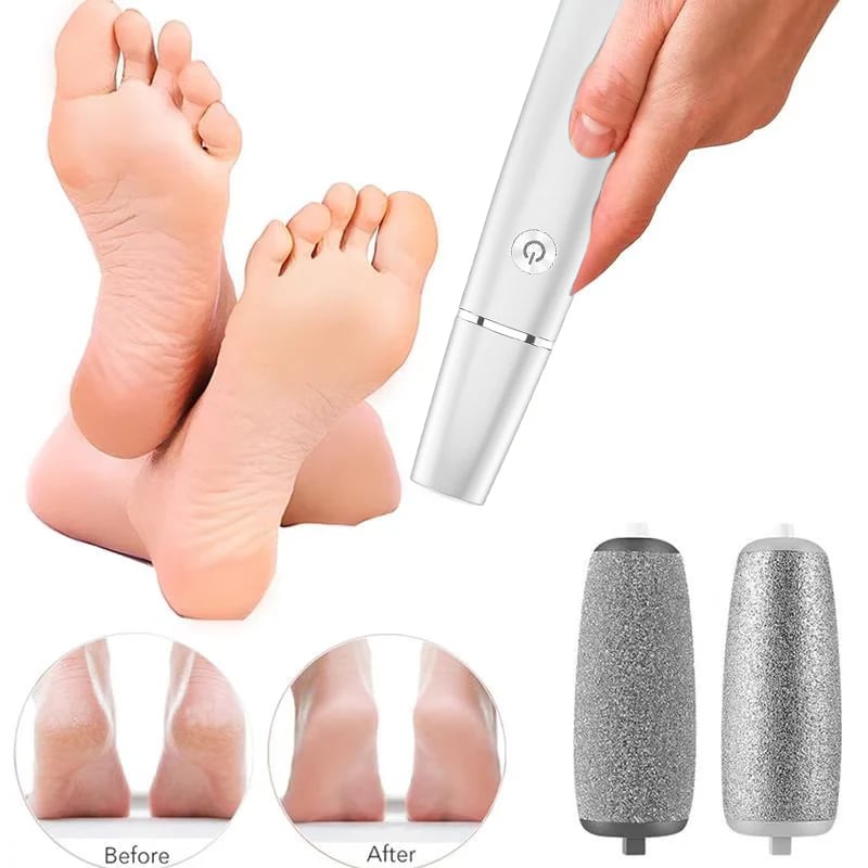 🔥Last Day Promotion 50% OFF💥Electric Feet Callus Remover