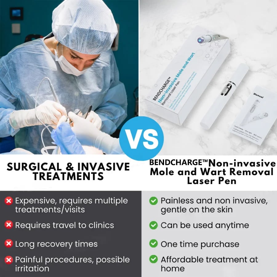 BENDCHARGE™ Non-Invasive Mole and Wart Removal Laser Pen