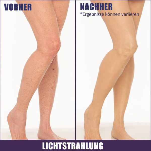 🔥LETZTER TAG 49 % RABATT🌟Körper-Concealer-Perfektionscreme – Feuchtigkeitsspendend, langanhaltend, leicht und wasserfest, 4 in 1💧✨