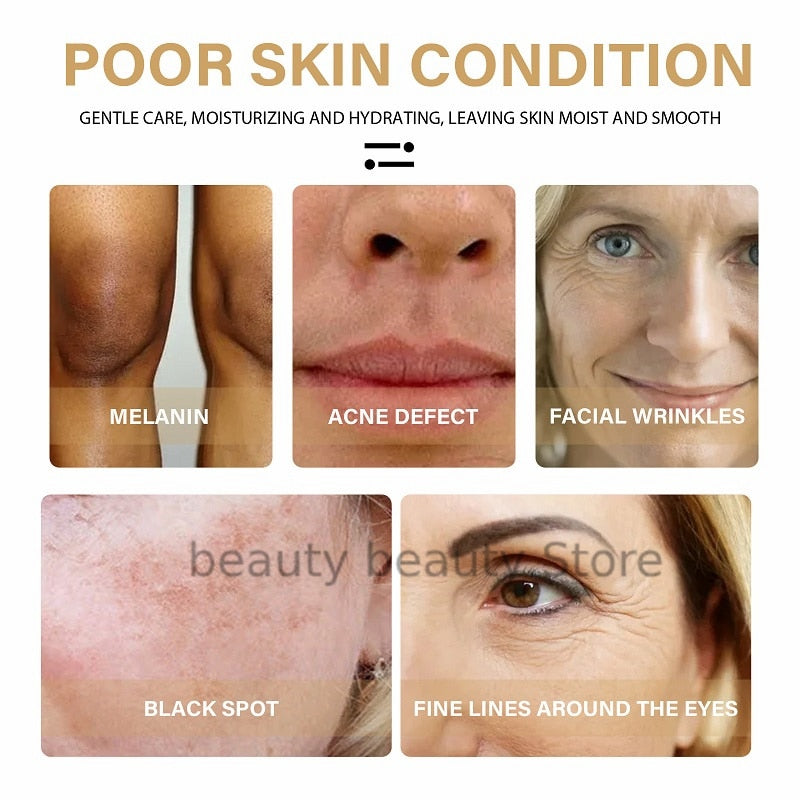 🔥2023 HOT SLAE🎁-Turmeric Spot Correcting Serum