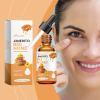 ⏰LAST DAY SALE 50% OFF🐝Genuine Honey Eye Cleansing Serum