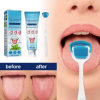 🔥2023New Year Sale -Probiotic Tongue Cleaning Gel Set(🔥Buy 4 get 4 Free & Free Shipping)