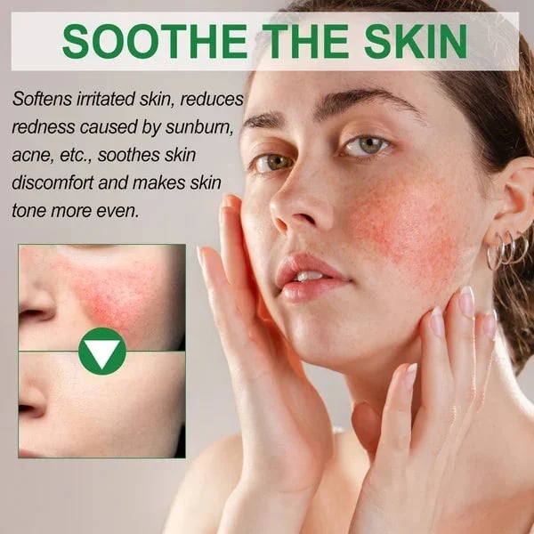 (🎉Last Day Promotion 50% OFF) Color Correcting Treatment Cream