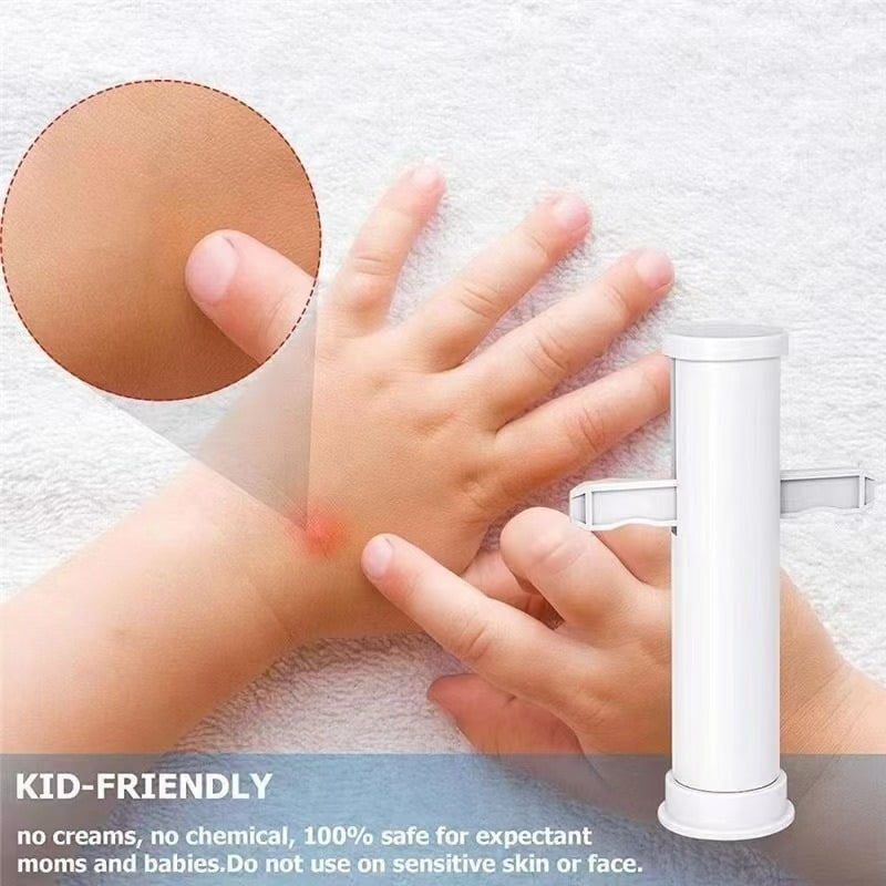 🎁TikTok Last Day Sale - 70% OFF🔥Bug Bite Suction Tool🦟 - Relieve itching and swelling✅