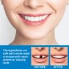 Clinclii™ Moldable False Teeth Restore Your Smile, Anytime. Anywhere