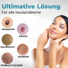 🎁-✨BENDCHARGE™ Nicht-invasiver Laser-Stift zur Entfernung von Muttermalen und Warzen✨