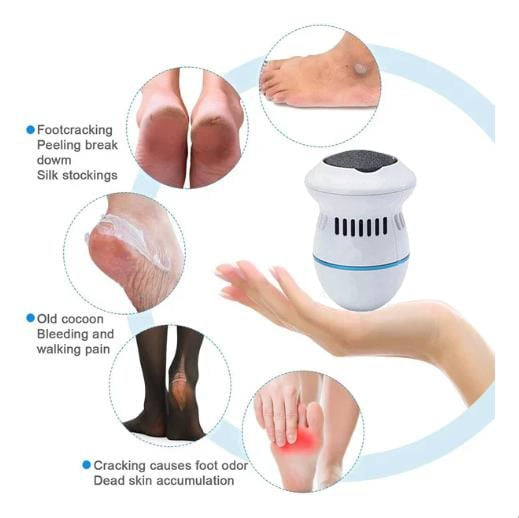 💝2023 Father's Day Save 48% OFF🎁New Electric Foot Grinder(BUY 2 GET FREE SHIPPING)